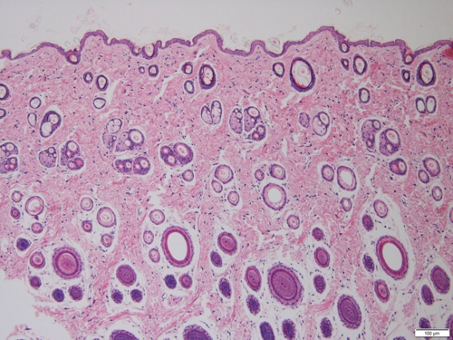 Thicktm 皮膚 Of 超微形態科学分野
