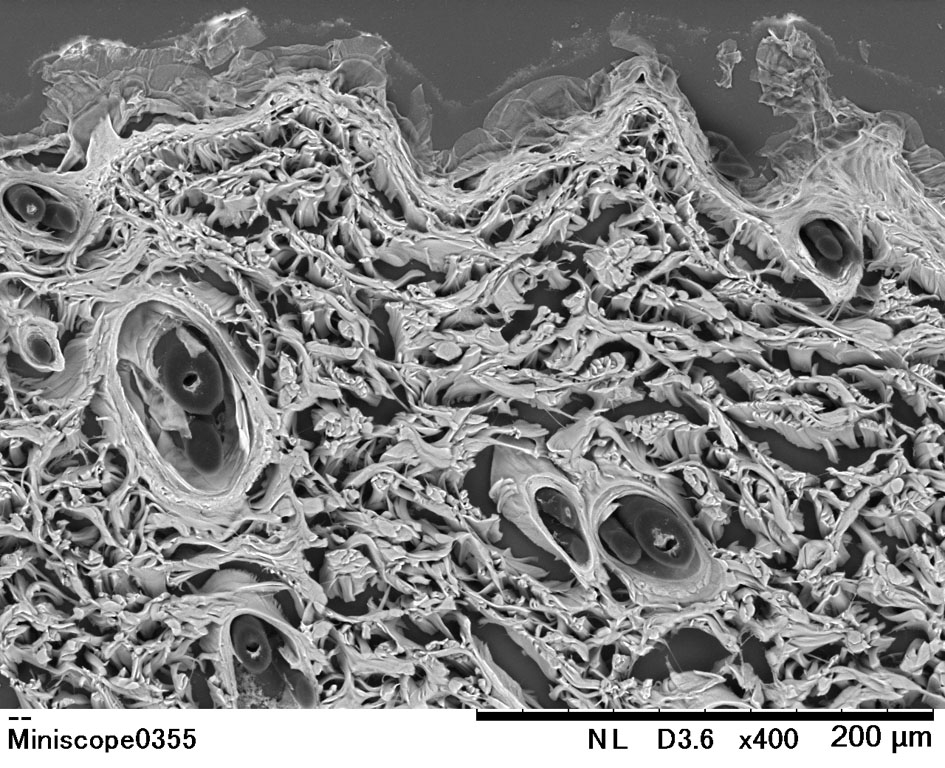Thicktm 皮膚 Of 超微形態科学分野